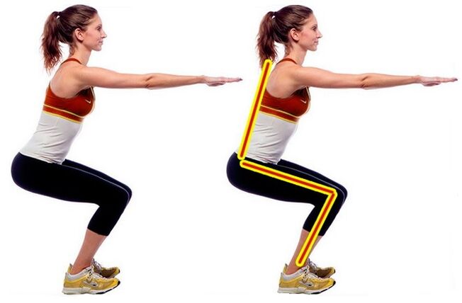 squats para varices